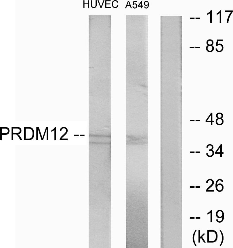Western blot analysis of lysates from HUVEC and A549 cells using Anti-PRDM12 Antibody. The right hand lane represents a negative control, where the antibody is blocked by the immunising peptide.