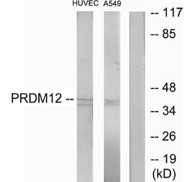 Western Blot - Anti-PRDM12 Antibody (C11694) - Antibodies.com