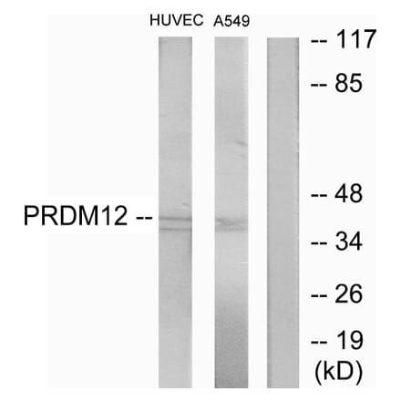 Western Blot - Anti-PRDM12 Antibody (C11694) - Antibodies.com