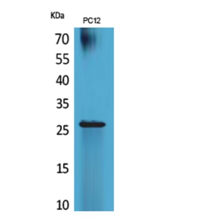 Western Blot - Anti-POLR3G Antibody (C30981) - Antibodies.com