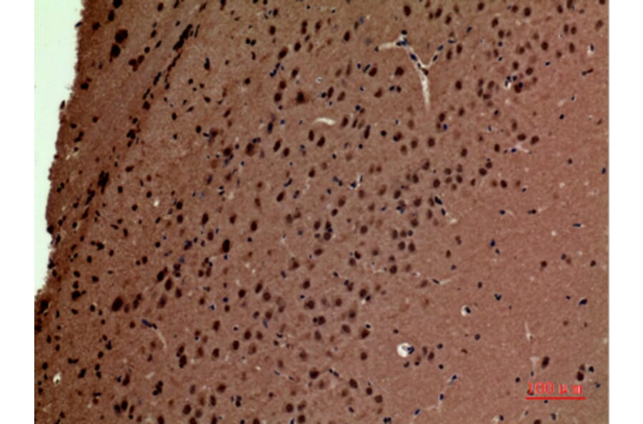 Immunohistochemistry - Anti-POLR3G Antibody (C30981) - Antibodies.com