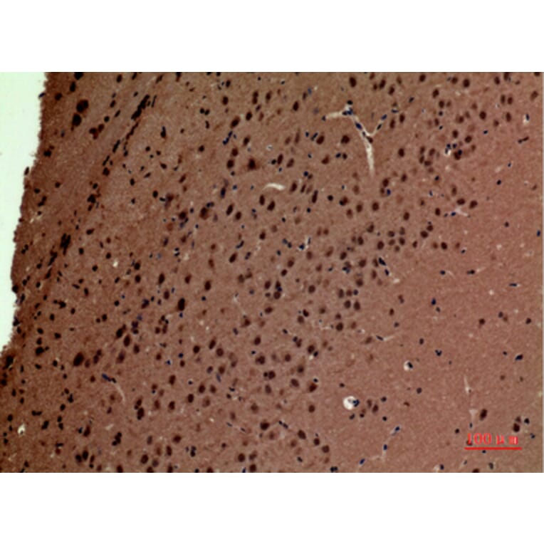 Immunohistochemistry - Anti-POLR3G Antibody (C30981) - Antibodies.com