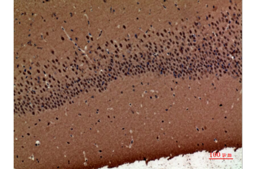 Immunohistochemistry - Anti-POLR3G Antibody (C30981) - Antibodies.com