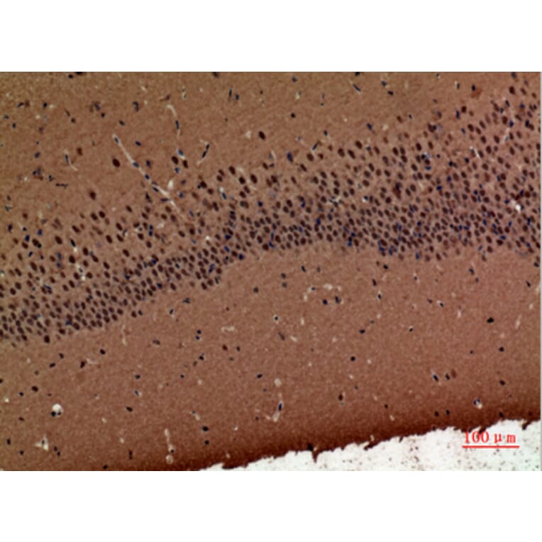 Immunohistochemistry - Anti-POLR3G Antibody (C30981) - Antibodies.com