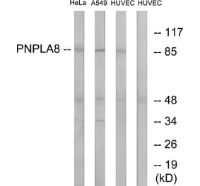 Western Blot - Anti-PNPLA8 Antibody (C14856) - Antibodies.com