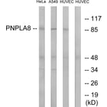 Western Blot - Anti-PNPLA8 Antibody (C14856) - Antibodies.com