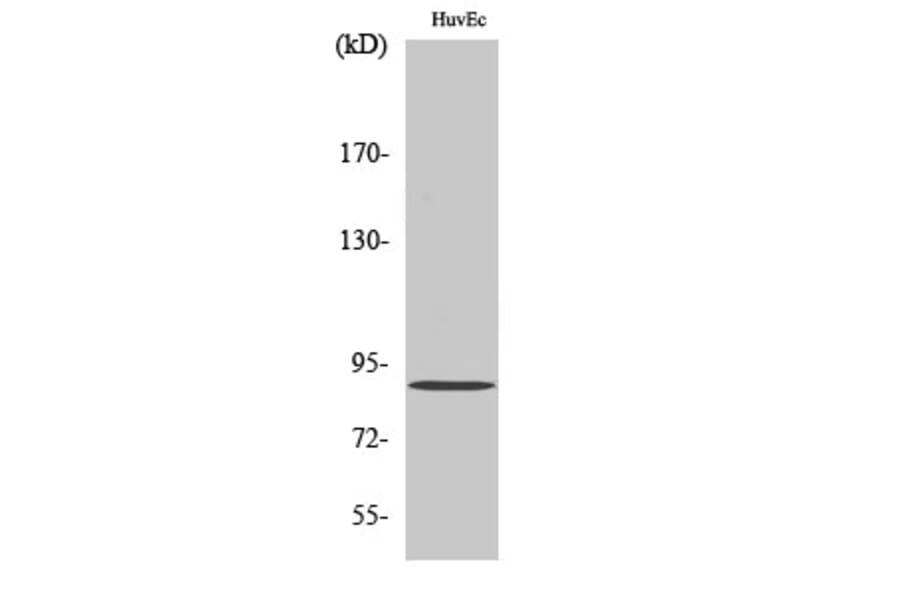 Western Blot - Anti-PNPLA8 Antibody (C14856) - Antibodies.com