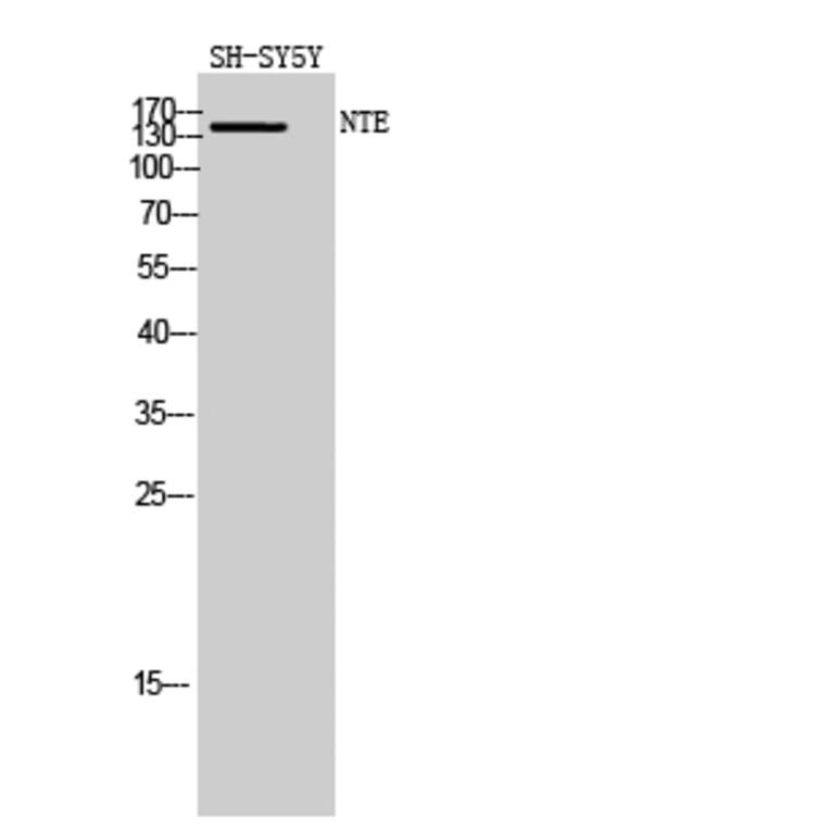 Western Blot - Anti-PNPLA6 Antibody (C17011) - Antibodies.com