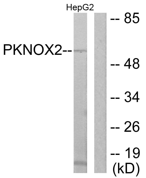 Western blot analysis of lysates from HepG2 cells using Anti-PKNOX2 Antibody. The right hand lane represents a negative control, where the antibody is blocked by the immunising peptide.
