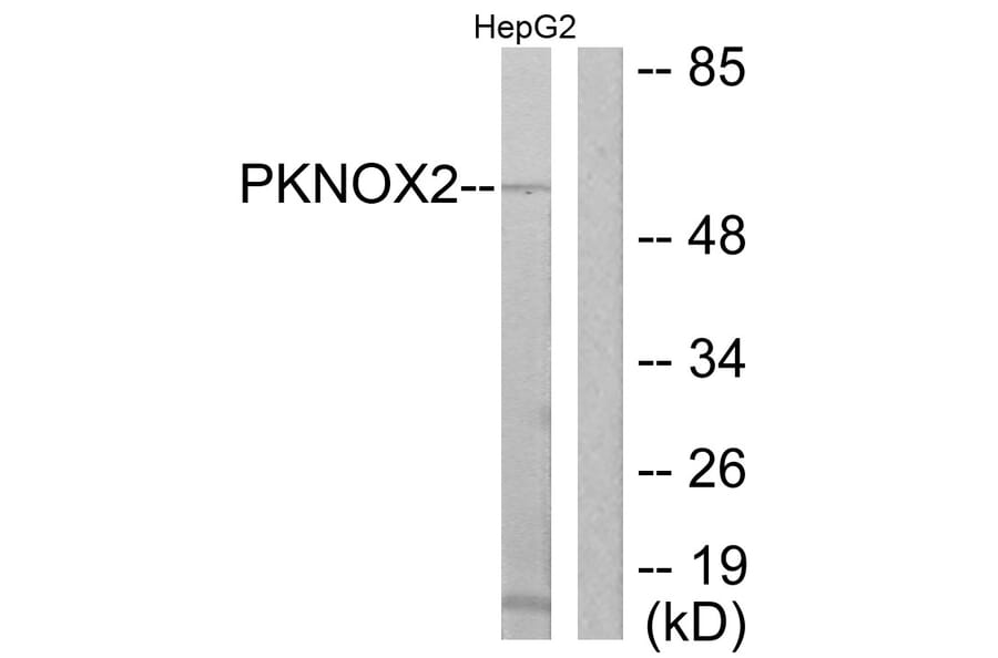 Western Blot - Anti-PKNOX2 Antibody (C11510) - Antibodies.com