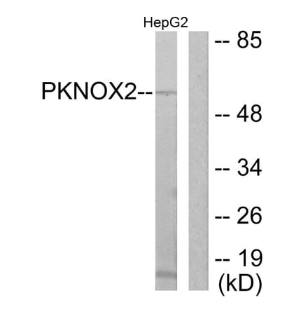 Western Blot - Anti-PKNOX2 Antibody (C11510) - Antibodies.com