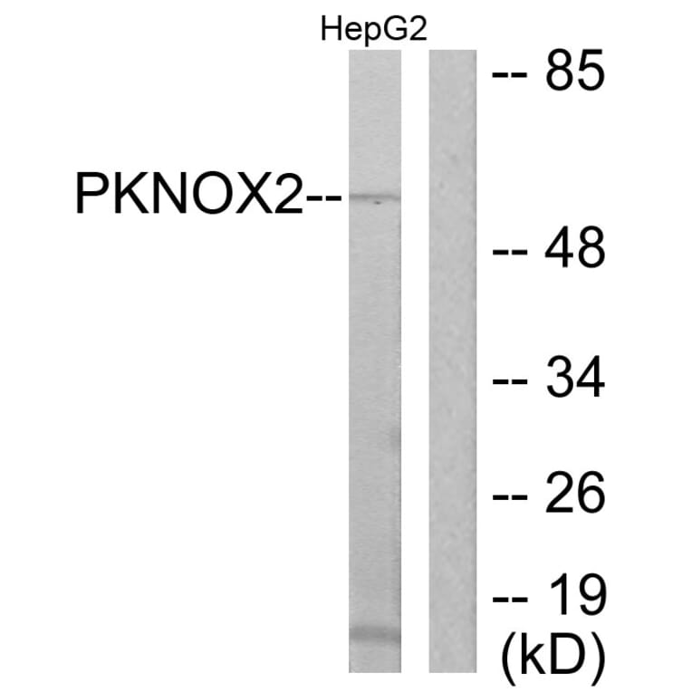 Western Blot - Anti-PKNOX2 Antibody (C11510) - Antibodies.com