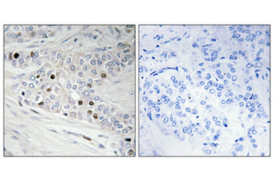 Immunohistochemistry - Anti-PKNOX2 Antibody (C11510) - Antibodies.com