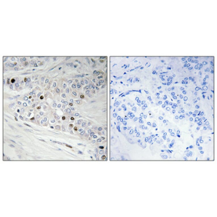Immunohistochemistry - Anti-PKNOX2 Antibody (C11510) - Antibodies.com