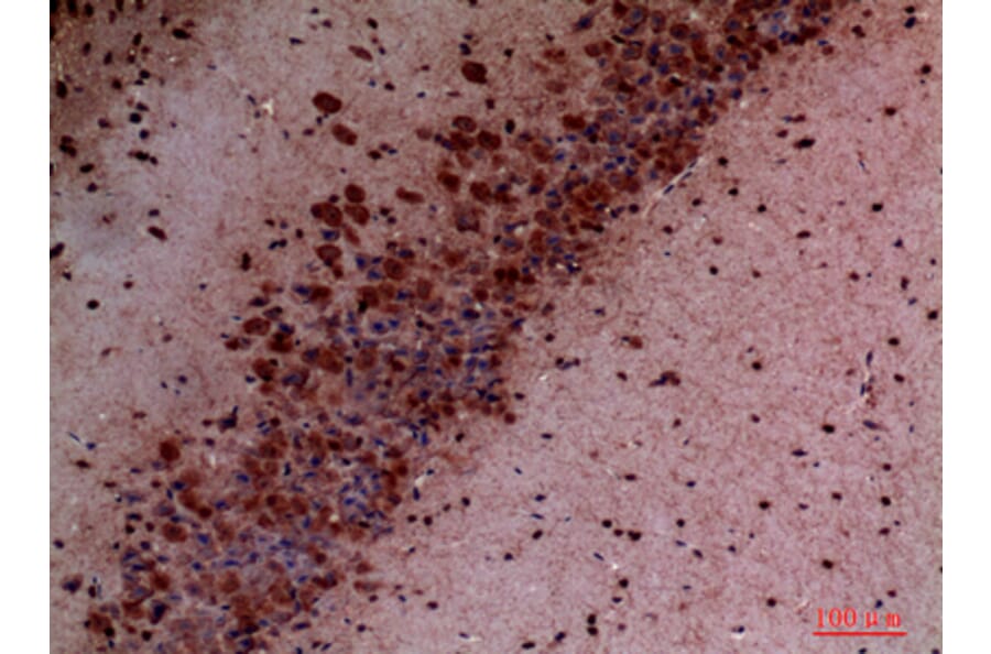 Immunohistochemistry - Anti-PIK3CD Antibody (C30995) - Antibodies.com