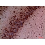 Immunohistochemistry - Anti-PIK3CD Antibody (C30995) - Antibodies.com