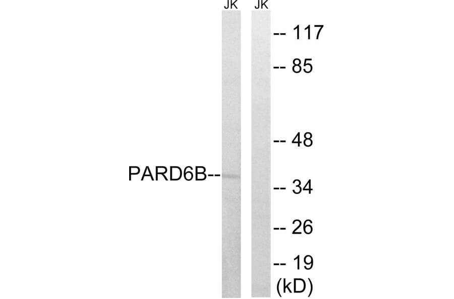 Western Blot - Anti-PARD6B Antibody (C17606) - Antibodies.com