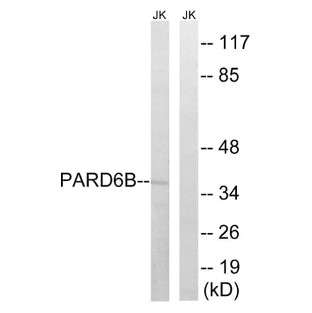 Western Blot - Anti-PARD6B Antibody (C17606) - Antibodies.com