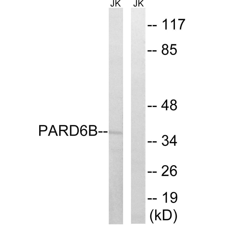 Western Blot - Anti-PARD6B Antibody (C17606) - Antibodies.com