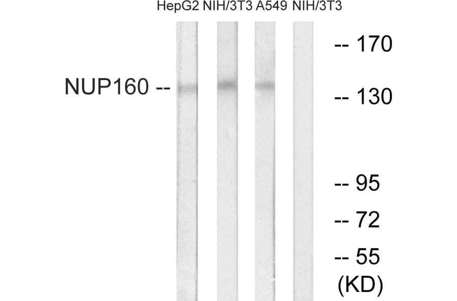 Western Blot - Anti-NUP160 Antibody (C17093) - Antibodies.com