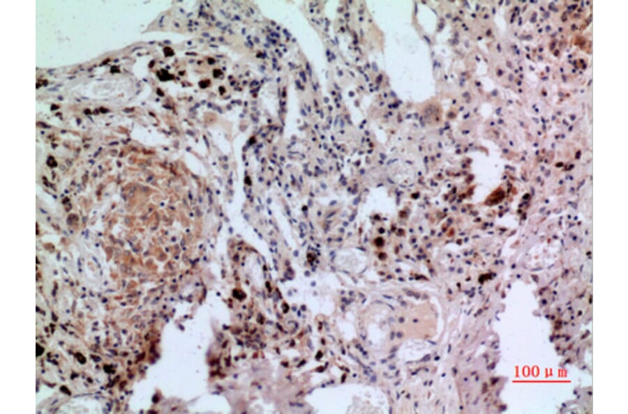 Immunohistochemistry - Anti-NFATC1 Antibody (C30249) - Antibodies.com