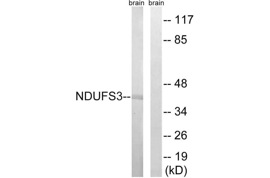 Western Blot - Anti-NDUFS3 Antibody (C16845) - Antibodies.com
