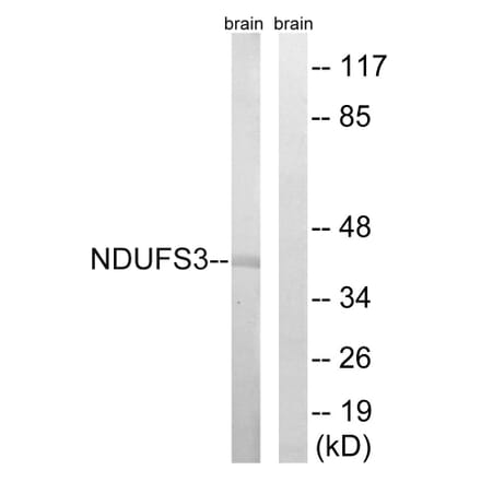 Western Blot - Anti-NDUFS3 Antibody (C16845) - Antibodies.com