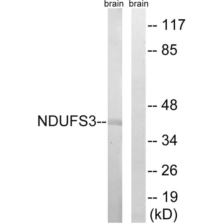 Western Blot - Anti-NDUFS3 Antibody (C16845) - Antibodies.com