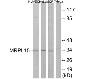 Western Blot - Anti-MRPL15 Antibody (C14059) - Antibodies.com