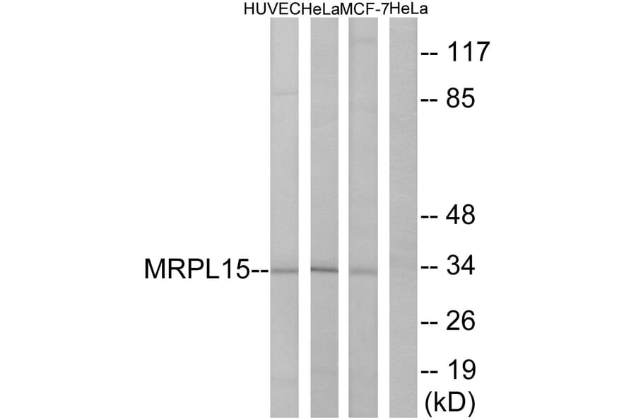 Western Blot - Anti-MRPL15 Antibody (C14059) - Antibodies.com