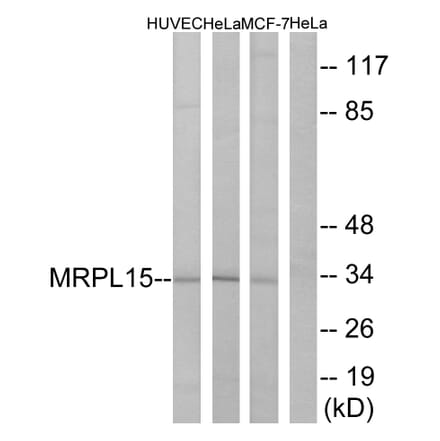 Western Blot - Anti-MRPL15 Antibody (C14059) - Antibodies.com