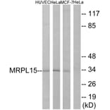 Western Blot - Anti-MRPL15 Antibody (C14059) - Antibodies.com
