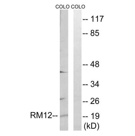 Western Blot - Anti-MRPL12 Antibody (C14056) - Antibodies.com