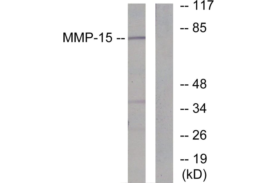 Western Blot - Anti-MMP-15 Antibody (C0267) - Antibodies.com