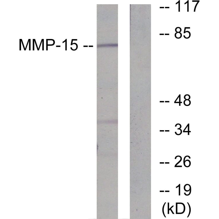 Western Blot - Anti-MMP-15 Antibody (C0267) - Antibodies.com