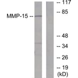 Western Blot - Anti-MMP-15 Antibody (C0267) - Antibodies.com