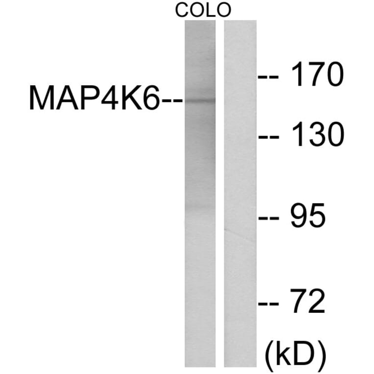 Western Blot - Anti-MAP4K6 Antibody (C11342) - Antibodies.com