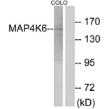 Western Blot - Anti-MAP4K6 Antibody (C11342) - Antibodies.com