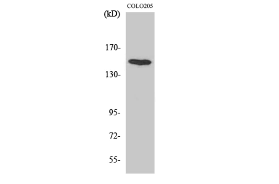 Western Blot - Anti-MAP4K6 Antibody (C11342) - Antibodies.com