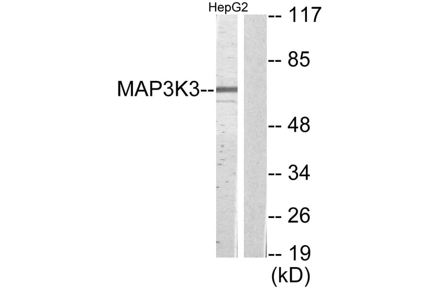 Western Blot - Anti-MAP3K3 Antibody (C11574) - Antibodies.com