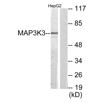 Western Blot - Anti-MAP3K3 Antibody (C11574) - Antibodies.com