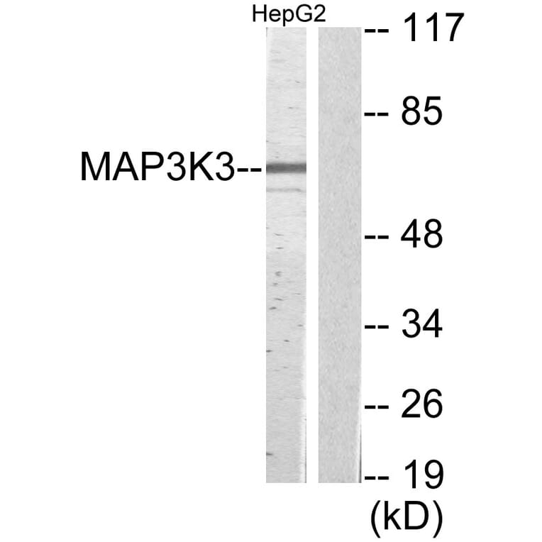 Western Blot - Anti-MAP3K3 Antibody (C11574) - Antibodies.com