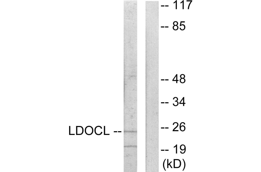 Western Blot - Anti-LDOC1L Antibody (C11219) - Antibodies.com