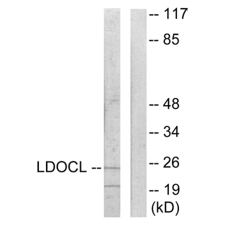 Western Blot - Anti-LDOC1L Antibody (C11219) - Antibodies.com