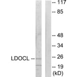 Western Blot - Anti-LDOC1L Antibody (C11219) - Antibodies.com