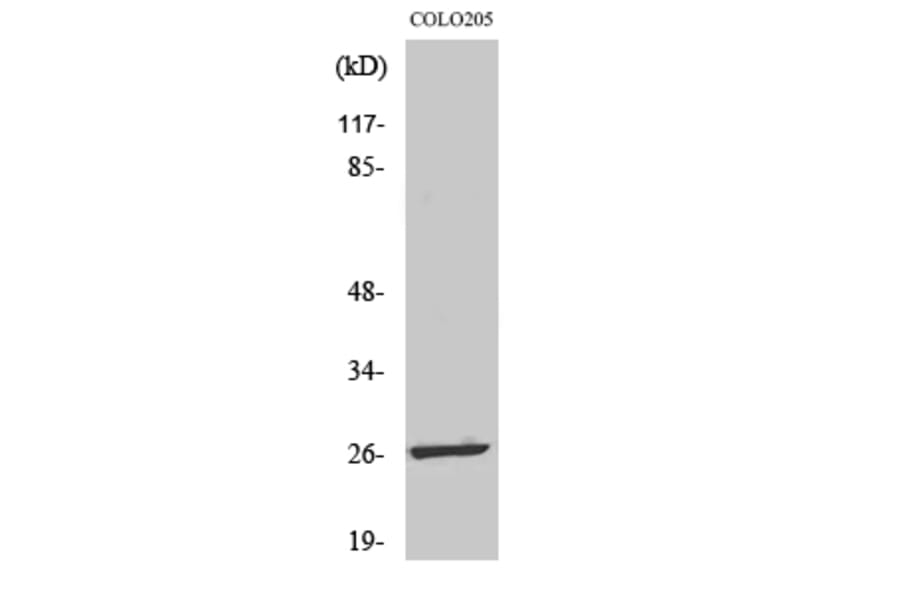 Western Blot - Anti-LDOC1L Antibody (C11219) - Antibodies.com