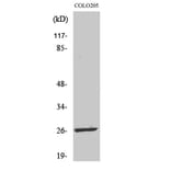 Western Blot - Anti-LDOC1L Antibody (C11219) - Antibodies.com