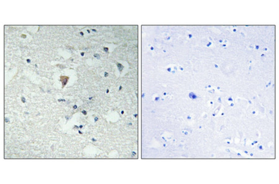 Immunohistochemistry - Anti-LDOC1L Antibody (C11219) - Antibodies.com