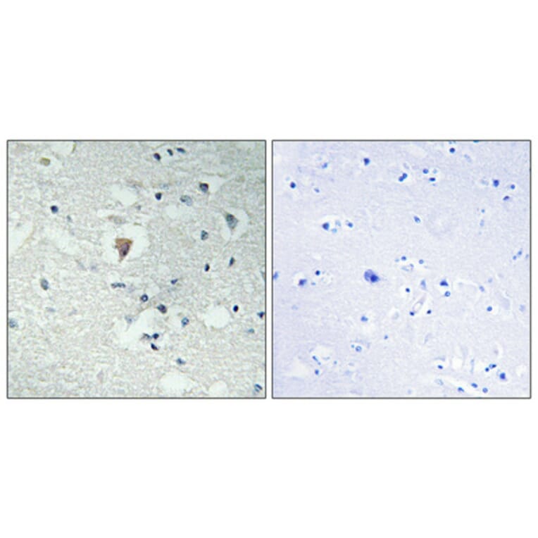 Immunohistochemistry - Anti-LDOC1L Antibody (C11219) - Antibodies.com