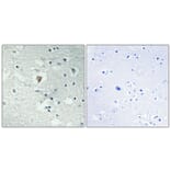 Immunohistochemistry - Anti-LDOC1L Antibody (C11219) - Antibodies.com